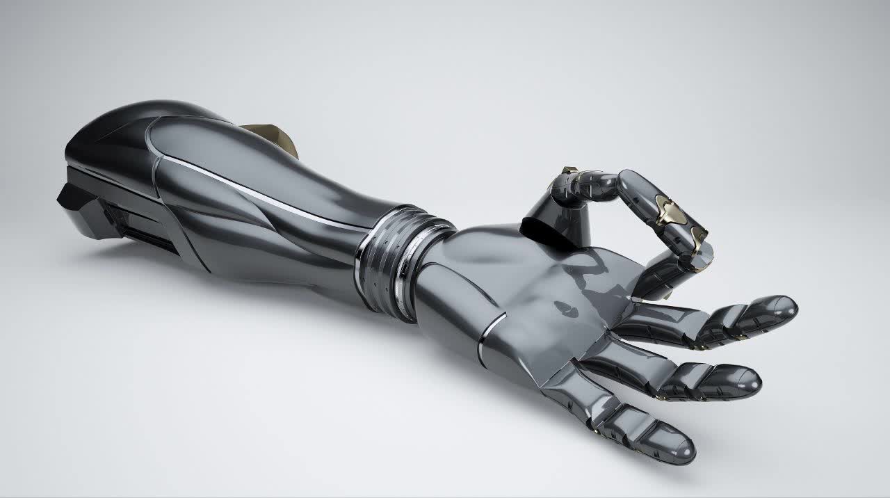 Patient testing an advanced bionic arm prosthesis at a specialized clinic in Turkey
