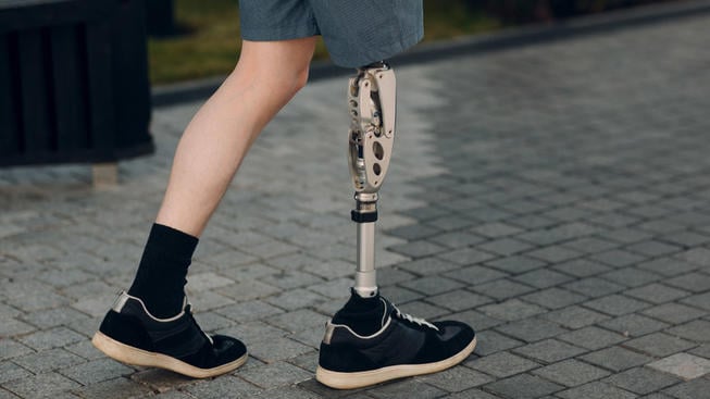 A person adjusting their prosthetic leg liner for better comfort