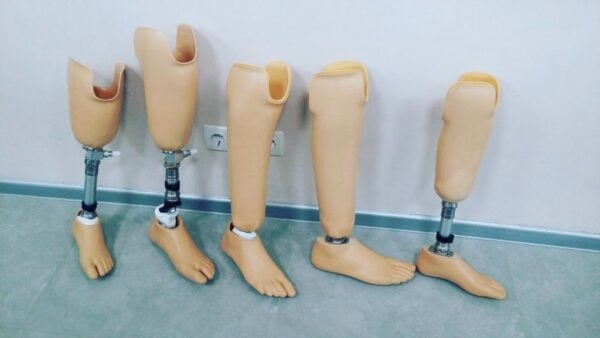 Protez bacak kullanan bir hastanın güdük bakımı ve cilt kontrolü yapması
