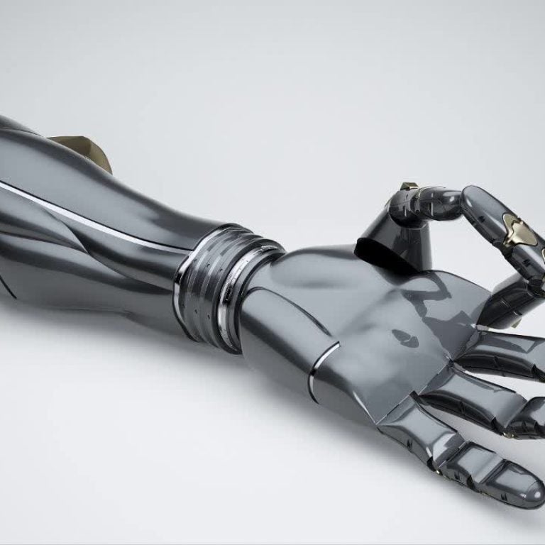Patient testing an advanced bionic arm prosthesis at a specialized clinic in Turkey