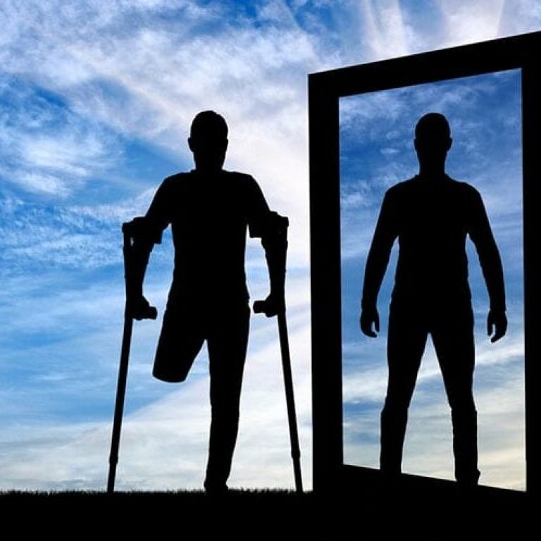 Amputasyon sonrası fantom ağrı ve tedavi yöntemleri