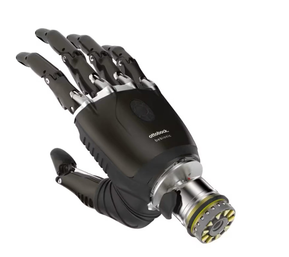 ottobock bebionic prosthetic arm